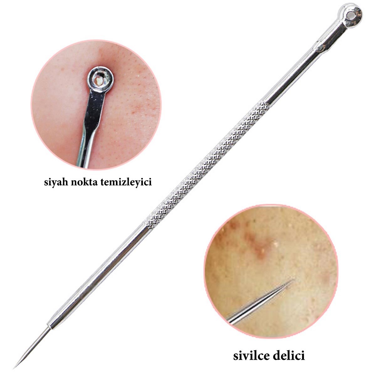 Paslanmaz Çelik Siyah Nokta Sivilce ve Akne Temizleyici Set 3&apos;lü Kit